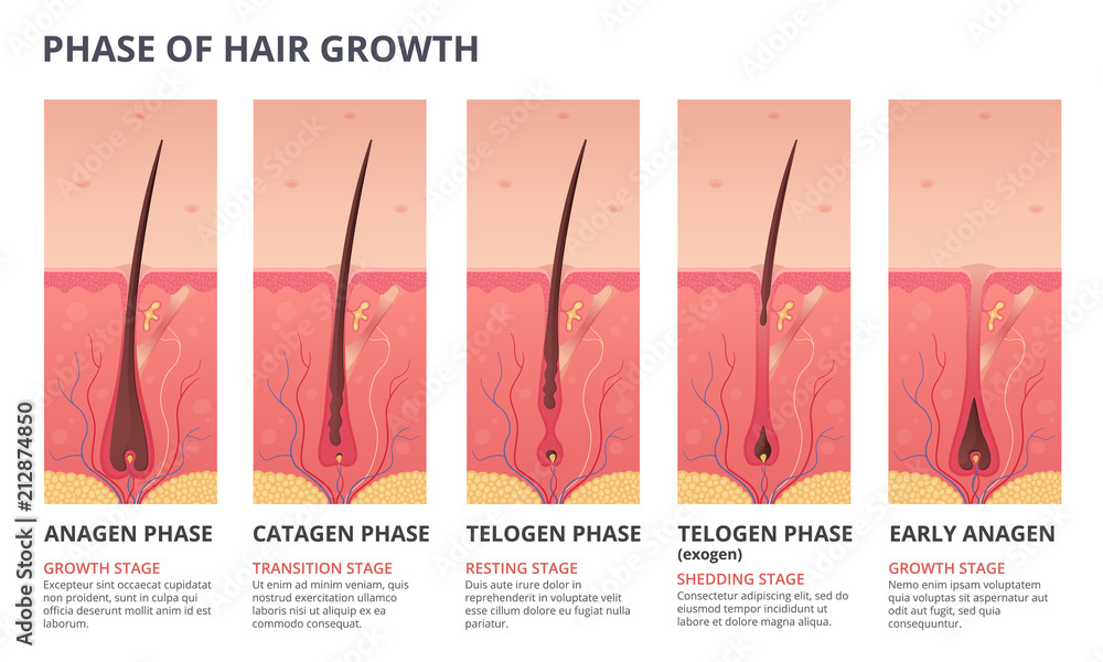 Medical infographic illustrations of hair growth cycle. Vector pictures of human biology - obrazy, fototapety, plakaty 