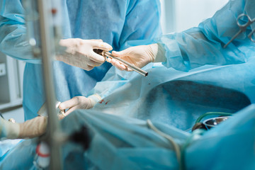 Close up of hands of surgeons team during process operation uterus removal with surgical laparoscopy instruments. Gynecology.