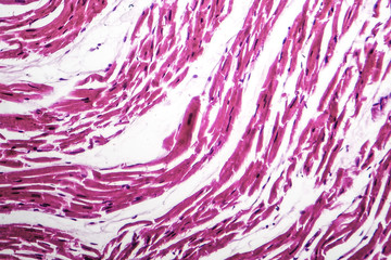 Poster - Brown atrophy of the heart, light micrograph, photo under microscope