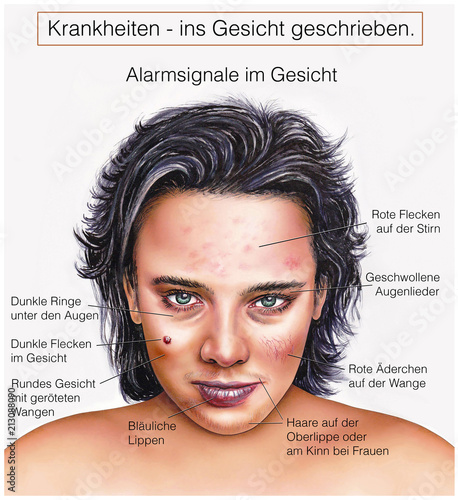Alarm-Signale im Gesicht-Krankheiten – kaufen Sie diese Illustration und finden Sie ähnliche ...