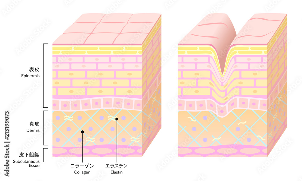 やさしい色合いの 立体的な肌の断面図 健康な肌とダメージ肌 Stock Gamesageddon