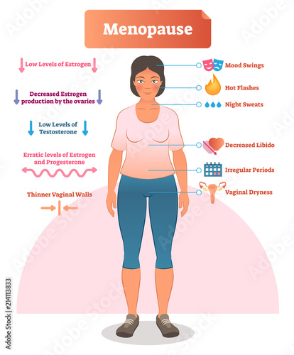 Menopause labeled vector illustration. Medical scheme and diagram with list of estrogen, ovaries, testosterone and progesterone symptoms. Anatomical explanation set.