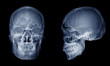 © Choo - Very good quality X-ray image of normal human skull front (AP) view and side (Lateral) view, Process in blue tone isolated on black background.