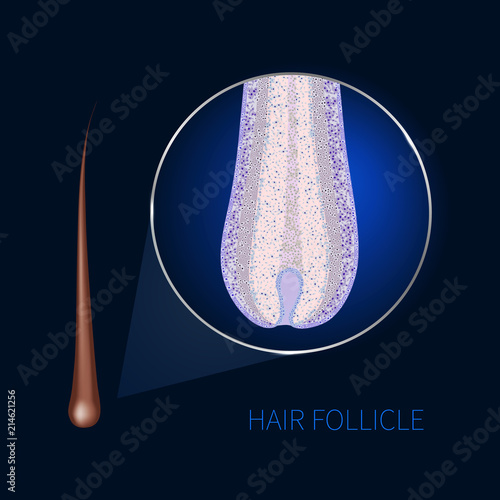 Hair bulb under the microscope. Follicle structure closeup. Removal