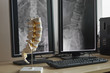 Human lumbar spine model and background of x-rays lumbar spine
