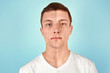 © New Africa - Young man with acne problem on color background