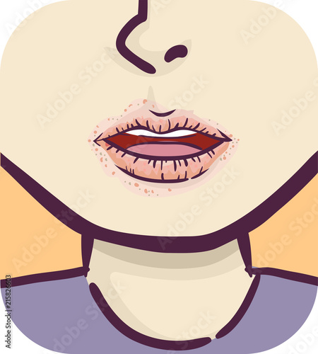 Symptoms Girl Dry Mouth Illustration Stock Vector | Adobe Stock