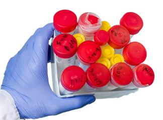 Poster - A set of large test tubes with red stoppers in a box.