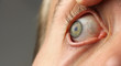 © Den - wide open human eye, pupil is looking to the side, closeup macro, copy space