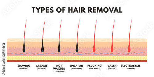 Hair Removal Concept Shaving Depilation Cream Waxing Epilator Plucking Laser Hair Removal