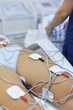 © nikodash - Treatment with electro stimulation