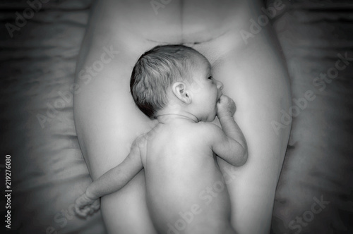 Fotomural Kaiserschnitt - cesarean section