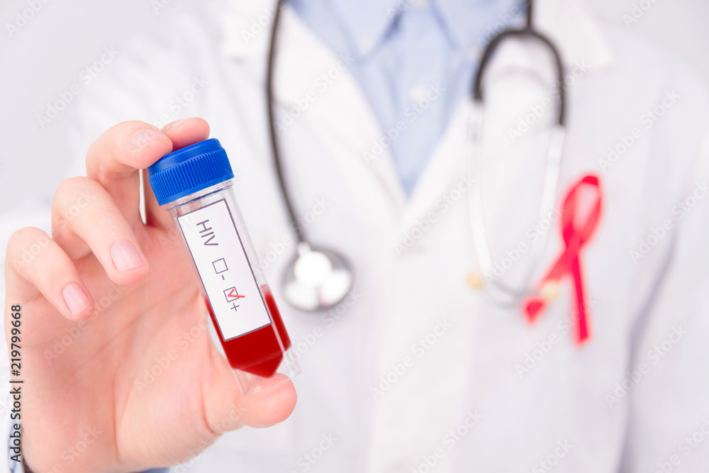 AIDS / HIV disease concept. Doctor wearing white coat and blue rubber medical gloves with pinned red ribbon as a symbol of aids / hiv and stethoscope holding negative tumor marker / blood test. - obrazy, fototapety, plakaty 