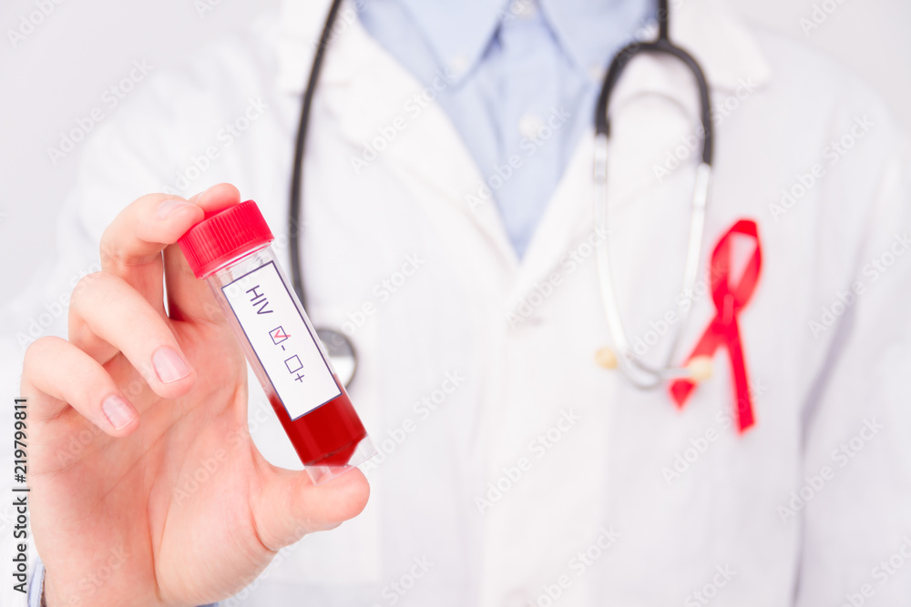 AIDS / HIV disease concept. Doctor wearing white coat and blue rubber medical gloves with pinned red ribbon as a symbol of aids / hiv and stethoscope holding positive tumor marker / blood test. - obrazy, fototapety, plakaty 