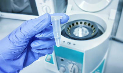 Gloved hand holds an Eppendorf tube with a sample, part of DNA extraction procedure