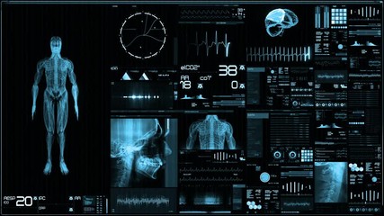 Blue futuristic patient monitor screen in perspective / Medical screen interface. Screen with various parameters measured. ST-segment and heart attack detection, pace-maker analysis, and arrhythmia an