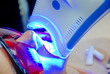 © Yulia - Adult  receiving teeth whitening procedure.portrait of a female patient at dentist in the clinic. Teeth whitening with ultraviolet light UV lamp. LED lamp for Teeth  procedure in the dental office