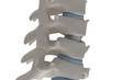Artificial intervertebral disc prosthesis is installed between the cervical vertebrae isolated on a white 3d render image