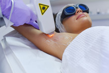 Epilation With A Diode Laser, Hair Removal With Laser