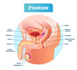 Prostate labeled vector illustration. Educational male anatomy scheme.