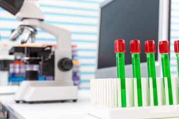 test tube in lab