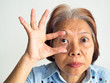 © Artlooking - retirement elderly old ages asia women have eyes pain cataract lasik eyes surgery treatment flu fever dizzy dull stabbing headaches throbbing solutions problem systems