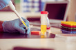 © luchschenF - A scientist in a medical laboratory with a dispenser in his hands is doing an genetic analysis samples