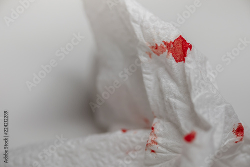 Fotografie, Obraz Red blood on tissue toilet paper. Health Care concept.