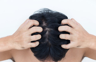 Young man suffering from itching her head, Itching scalp.