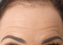 Beautiful Older Woman, Closeup Of Forehead