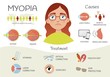 Infographics of myopia. Defects of vision. Illustration of a cute girl with glasses. Causes and treatment of the disease.