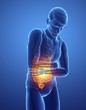 © Science RF - Man with abdominal pain, illustration