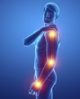© Science RF - Man with arm pain, illustration