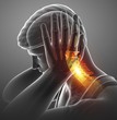 © Science RF - Man with neck pain, illustration