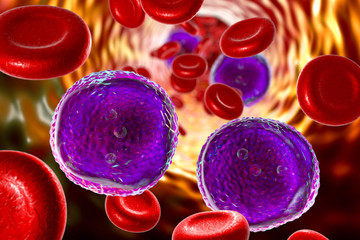 Wall Mural - Acute lymphoblastic leukemia, 3D illustration showing abundant lymphoblasts in blood