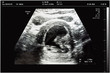 © ImagineDesign - An ultrasound of a mother fetus during the 08th week background as Medical and Health of the baby concept. vector illustration.
