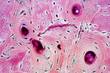 © tonaquatic - Histology of human compact bone tissue under microscope view for education