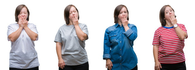 Canvas Print - Collage of down sydrome woman over isolated background bored yawning tired covering mouth with hand. Restless and sleepiness.