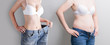 © ryanking999 - woman with abdomen loss concept