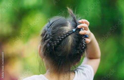 A Girl Scratch On Her Hair The Head Lice Makes Itself At Home On