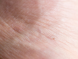 background of human skin macro