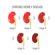 Chronic kidney disease vector