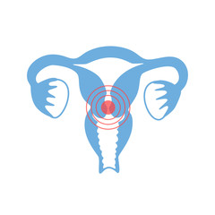 Wall Mural - Vector isolated illustration of uterus with pain