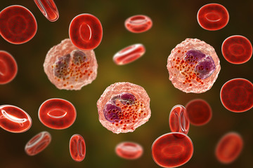 Poster - Eosinophilia, blood smear showing multiple eosinophils surround by red blood cells, 3D illustration. Eosinophilia occurs in parasitic and fungal infections, allergies, autoimmune disorders, tumors