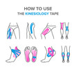 © anna_yakovets - how to use the kinesiology tape