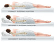 Correct and incorrect sleeping poses. Right and wrong position spine on different mattresses. Caring for health of back. 3d realistic vector illustration.