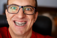 Crazy Face Of Guy With Braces On His Teeth With Smile And Glasses. Happy Expression. Portrait Of Man Close Up