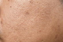Pores And Oily On Surface Young Asian Man Face Skin Do Not Take Care For A Long Time