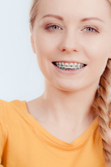 Wall Mural - Woman showing her teeth with braces