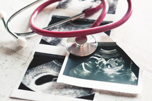 In The Pictures Of The Ultrasound 4 Weeks Of Pregnancy And 20 Weeks Is A Phonendoscope. The Concept Of The Study Of Pregnancy. Observation Selective Focus.